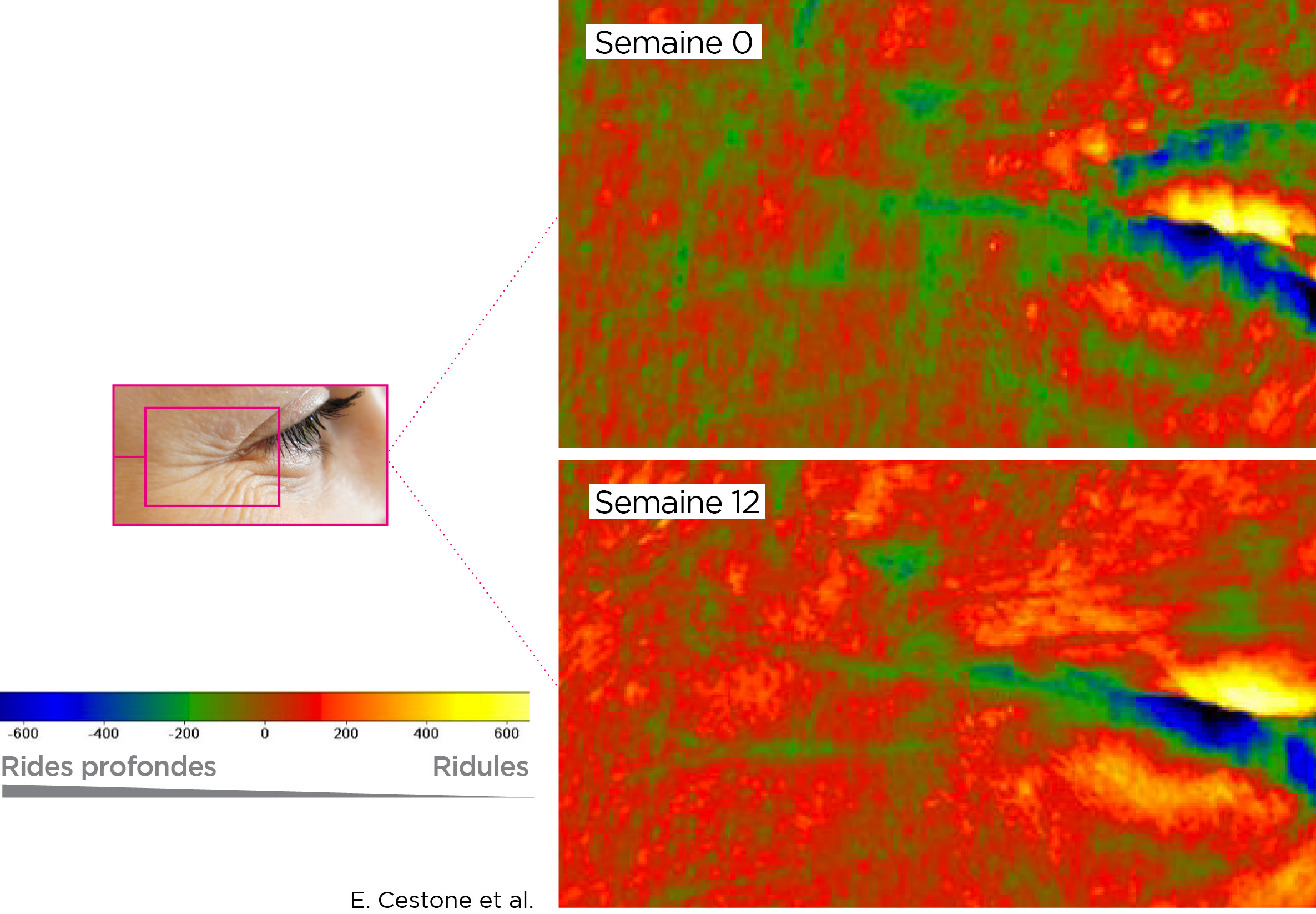 Photo microscope diminution de la profondeur des rides avec Lipowheat™